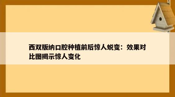 西双版纳口腔种植前后惊人蜕变：效果对比图揭示惊人变化